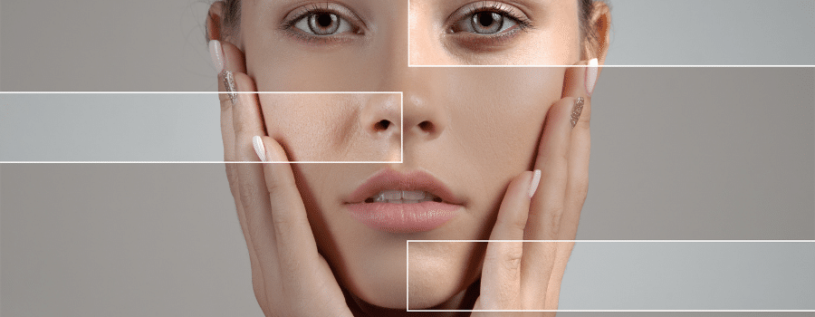 woman's face - skin restoration - skin treated without discomfort 